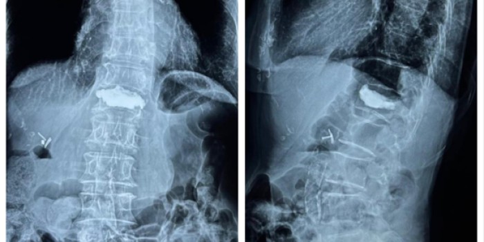 General and Minimally Invasive Surgery