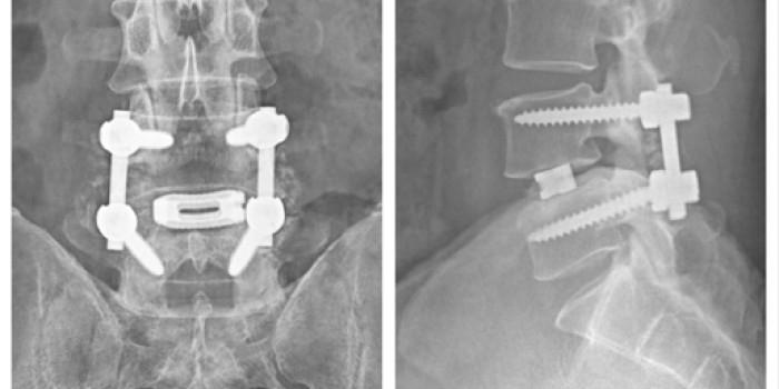 General and Minimally Invasive Surgery