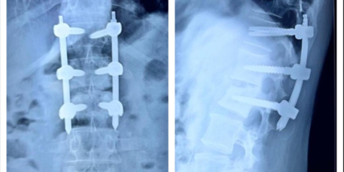 General and Minimally Invasive Surgery